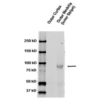 ENaC beta Antibody