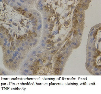 TNF Rabbit Polyclonal Antibody