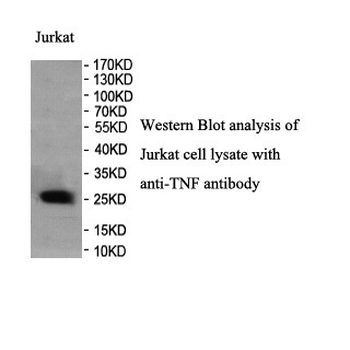 TNF Rabbit Polyclonal Antibody