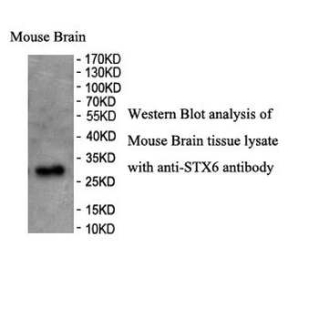 STX6 Rabbit Polyclonal Antibody
