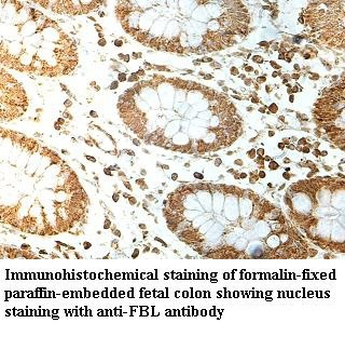 FBL Rabbit Polyclonal Antibody