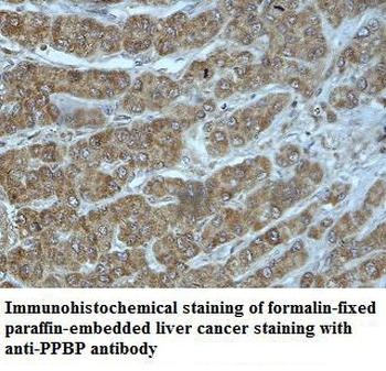 PPBP Rabbit Polyclonal Antibody