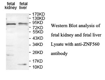ZNF560 Rabbit Polyclonal Antibody