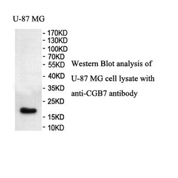 CGB7 Rabbit Polyclonal Antibody