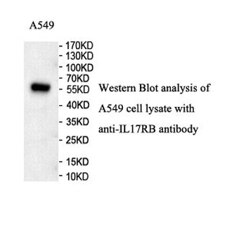 IL17RB Rabbit Polyclonal Antibody