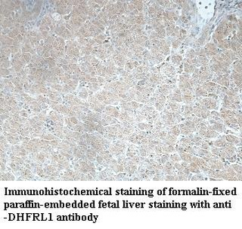 DHFRL1 Rabbit Polyclonal Antibody