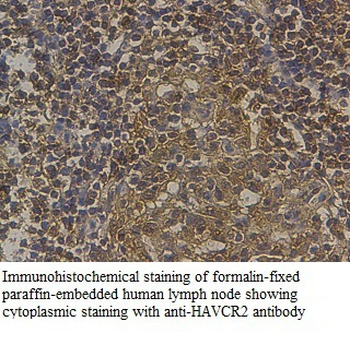 HAVCR2 Rabbit Polyclonal Antibody