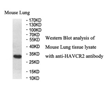 HAVCR2 Rabbit Polyclonal Antibody