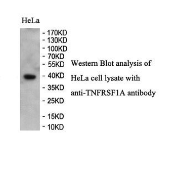 TNFRSF1A Rabbit Polyclonal Antibody
