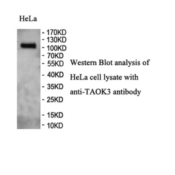 TAOK3 Rabbit Polyclonal Antibody