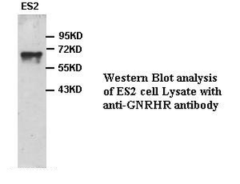 GNRHR Rabbit Polyclonal Antibody
