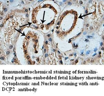 DCP2 Rabbit Polyclonal Antibody
