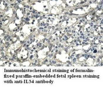 IL34 Rabbit Polyclonal Antibody