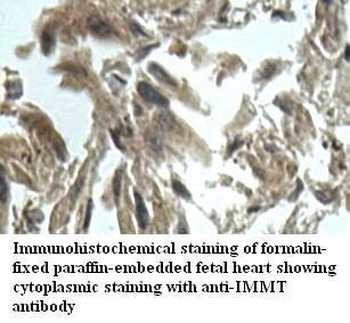 IMMT Rabbit Polyclonal Antibody