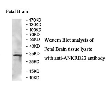 ANKRD23 Rabbit Polyclonal Antibody