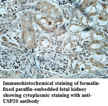 USP20 Rabbit Polyclonal Antibody