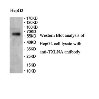 TXLNA Rabbit Polyclonal Antibody