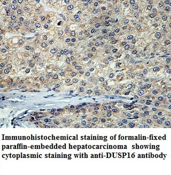 DUSP16 Rabbit Polyclonal Antibody