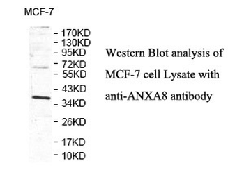 ANXA8 Rabbit Polyclonal Antibody