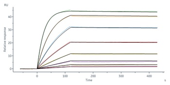Human IL-1 beta Protein, His Tag