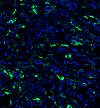 Goat anti-ACTA2 Antibody