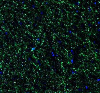 Goat anti-GAD65/GAD67 Antibody