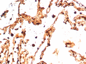 S100A4 Antibody