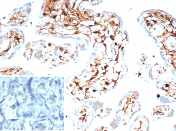 S100A4 Antibody