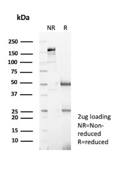 S100A4 Antibody