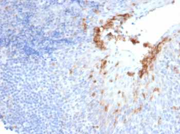 MME Antibody