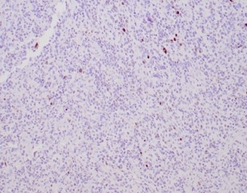 MGMT Antibody