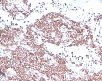 MGMT Antibody