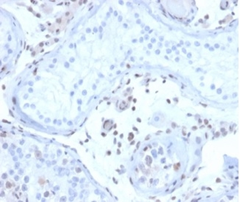 MGMT Antibody