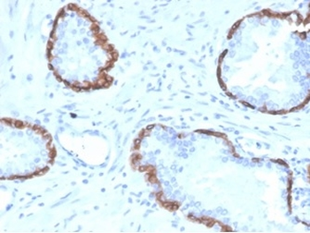 KRT14 Antibody