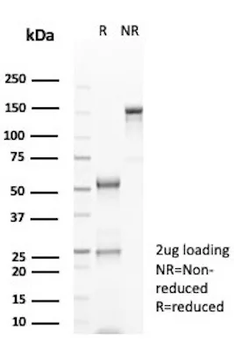 GFAP Antibody
