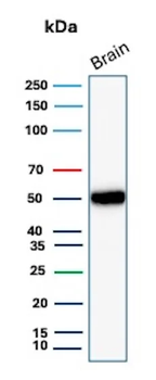 GFAP Antibody