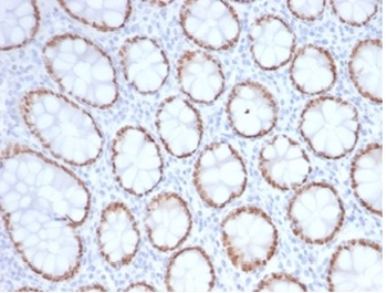 SATB2 Antibody