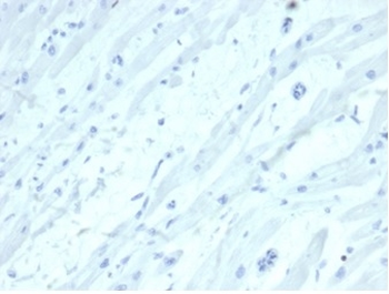SATB2 Antibody