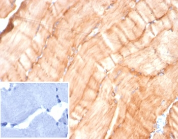 DES Antibody