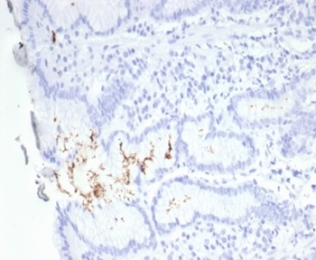 Helicobacter pylori (Catalase) Antibody