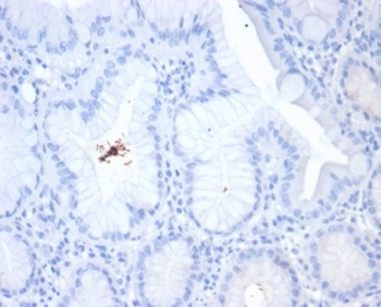 Helicobacter pylori (Catalase) Antibody