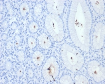 Helicobacter pylori (Catalase) Antibody