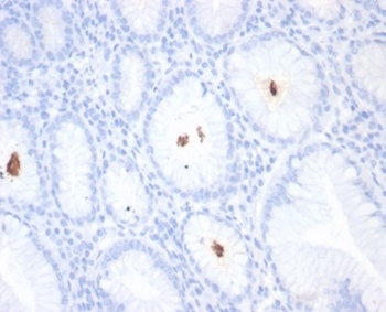 Helicobacter pylori (Catalase) Antibody