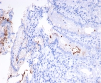 Helicobacter pylori (Catalase) Antibody