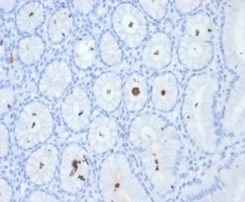 Helicobacter pylori (Catalase) Antibody