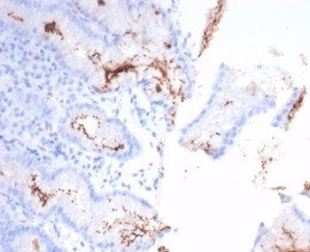Helicobacter pylori (Catalase) Antibody