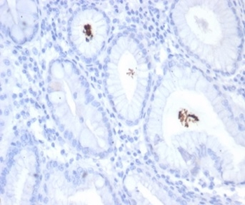 Helicobacter pylori (Catalase) Antibody
