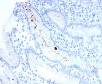 Helicobacter pylori (Catalase) Antibody