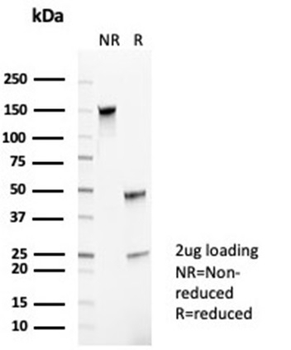 CR1 Antibody