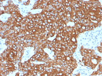 KRT18, KRT8 Antibody